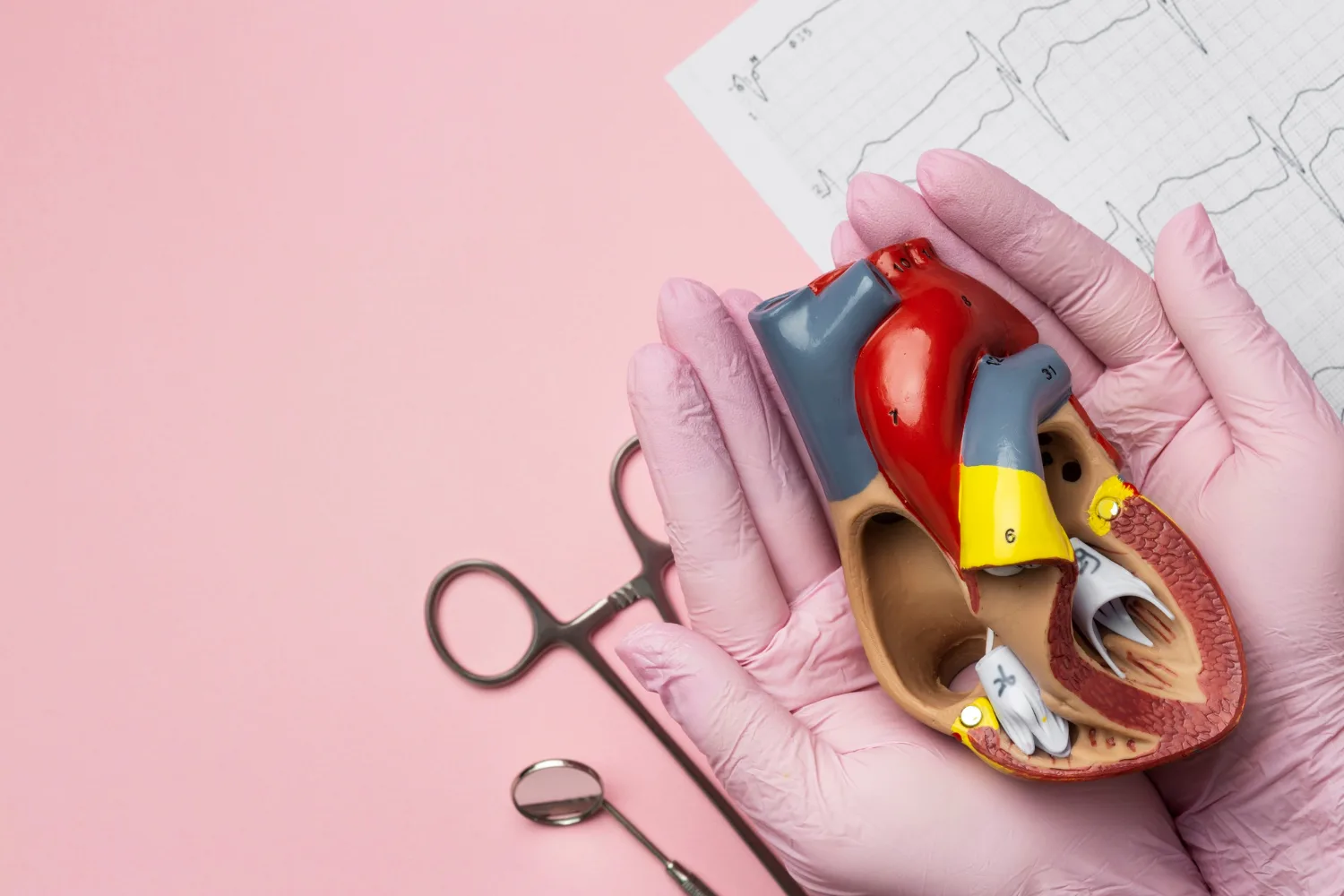 Reparación transcateter de válvula mitral