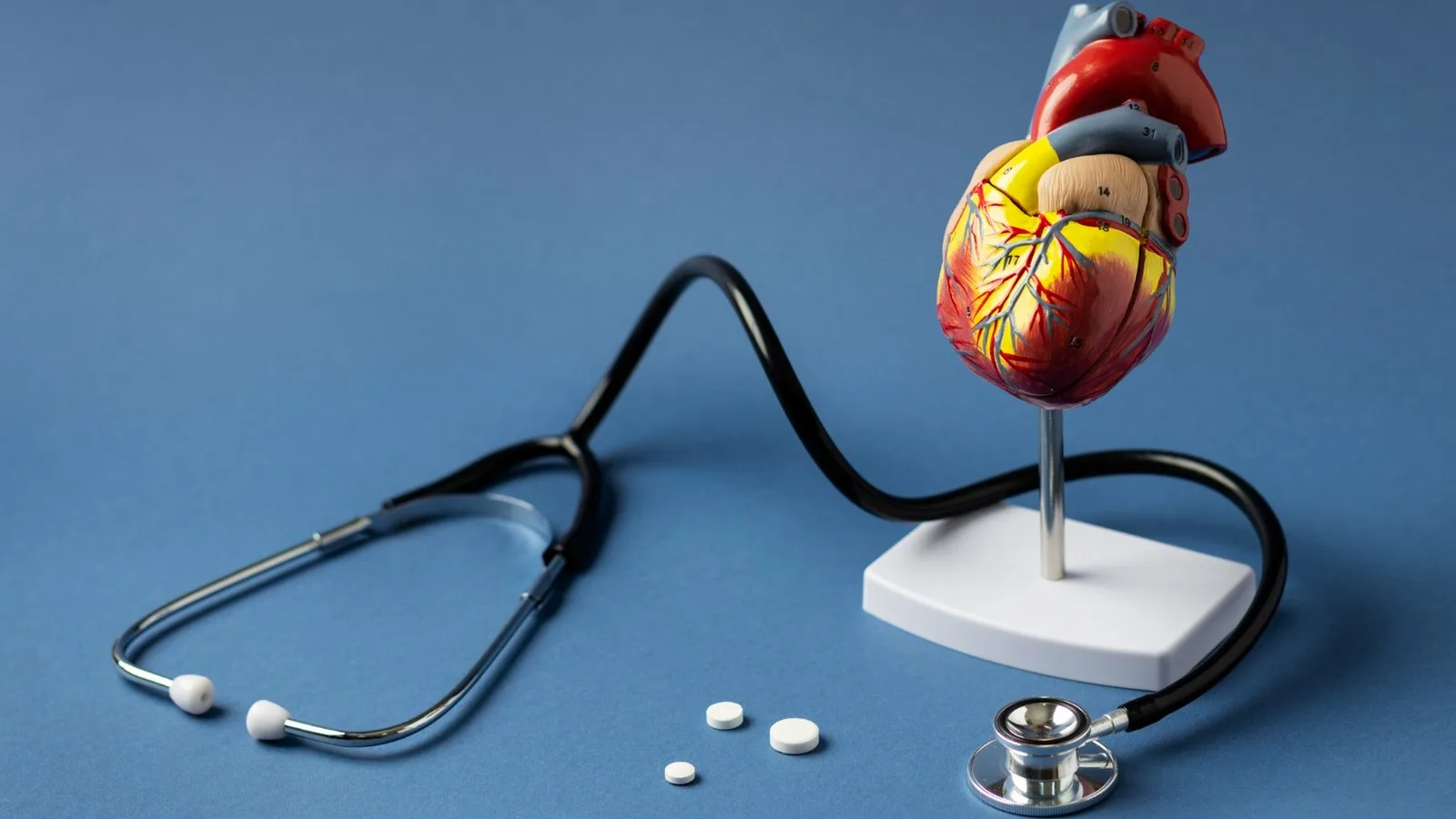 Antecedentes de infarto y evaluación cardiológica en Coyoacán CDMX
